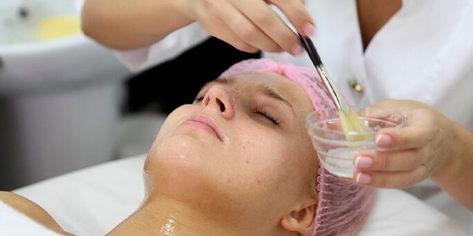 Jinek pêvajoyek peeling derbas dibe