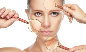 Çi pirsgirêkên çerm dikare nûvekirina fractional laser çareser bike